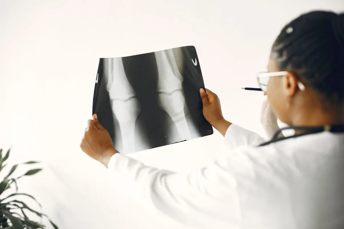 Doctor reviewing a knee X-ray